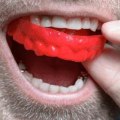 Are snoring mouthpiece bad for teeth?